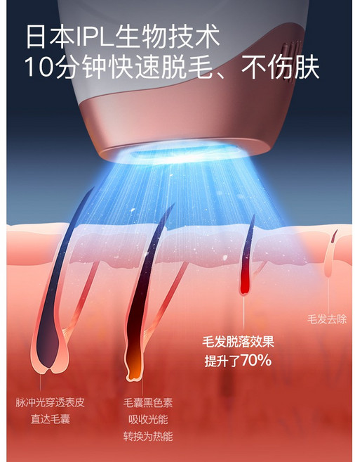 간편 가정용 레이저 제모기 레이저 빙점탈모기 불영구 여자입술 _14, 02 패셔너블한 여신3.0의미무통광탈모+화이