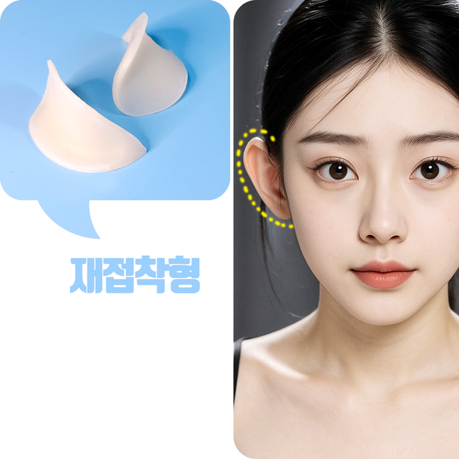 귀탱잇 - 귀필러 귀성형 귀교정기, 1개, 재접착형