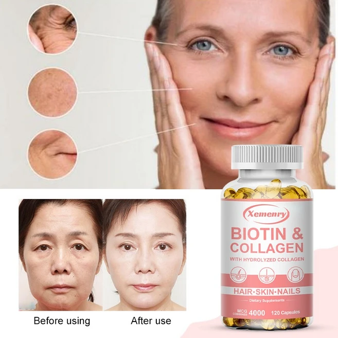 피부 모발 손톱 건강을 위한 콜라겐 비타민 캡슐 프리미엄 콜라겐 보충제, 1개, 30정 - 쿠팡