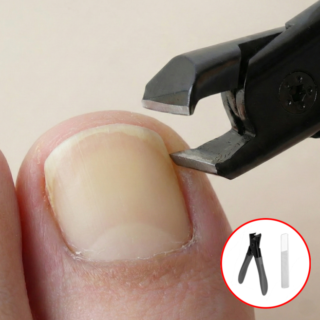더앤모어 두꺼운 발톱깍이 무좀 노인성 발톱 네일 클리퍼, 1개, 블랙