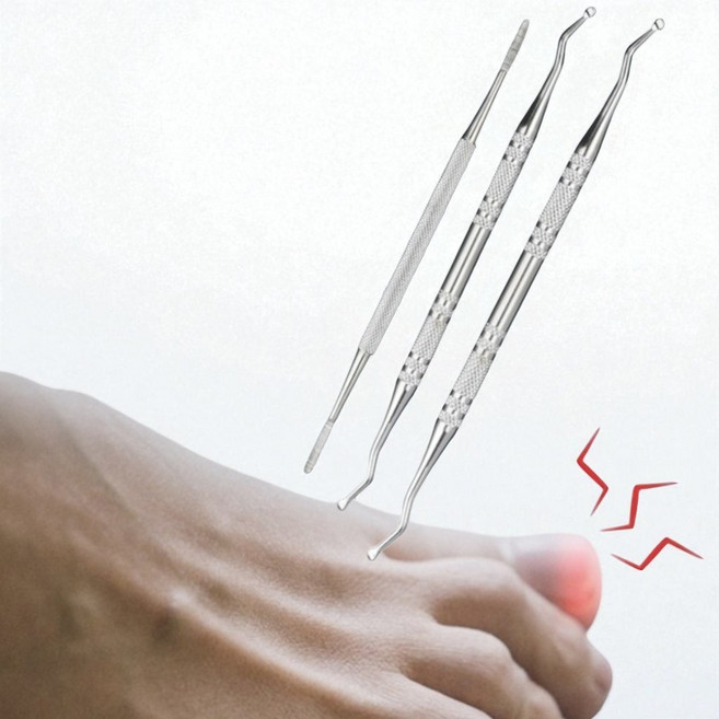 내성 발톱 자가 셀프 치료 3종 세트 정리, 내성발톱정리3종