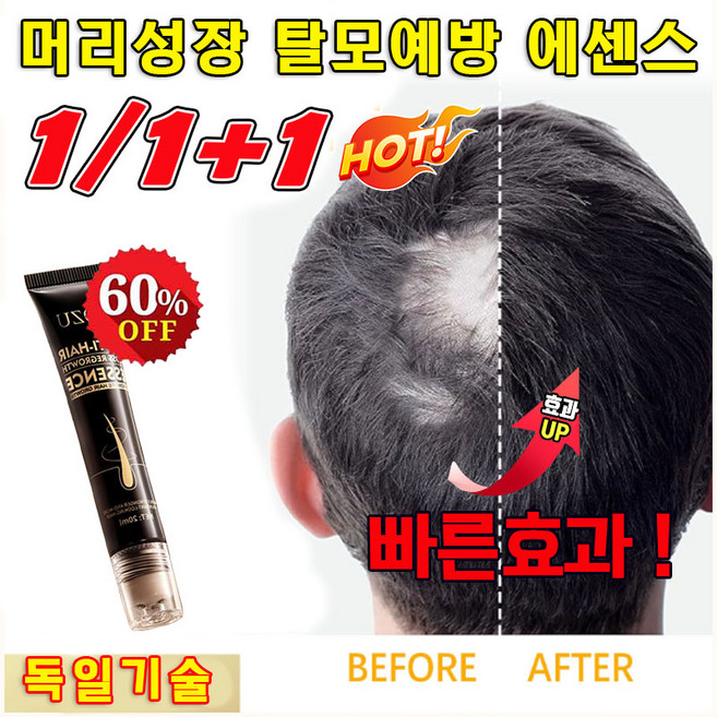 [오늘특가] 탈모 앰플 발모제 M자모발전문케어 블랙 성장 강화 모발관리 두피에센스 수염/눈썹/두피 양양제, 2개, 20ml