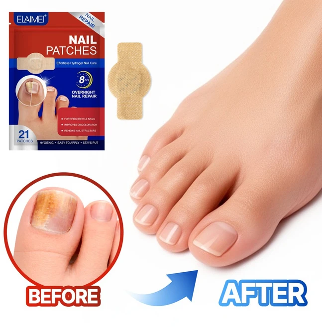 아임봄 변색된 발톱을 위한 패치 하이드로겔 케어 변형 보호 패치, 20g, 1개, 21개입 - 쿠팡