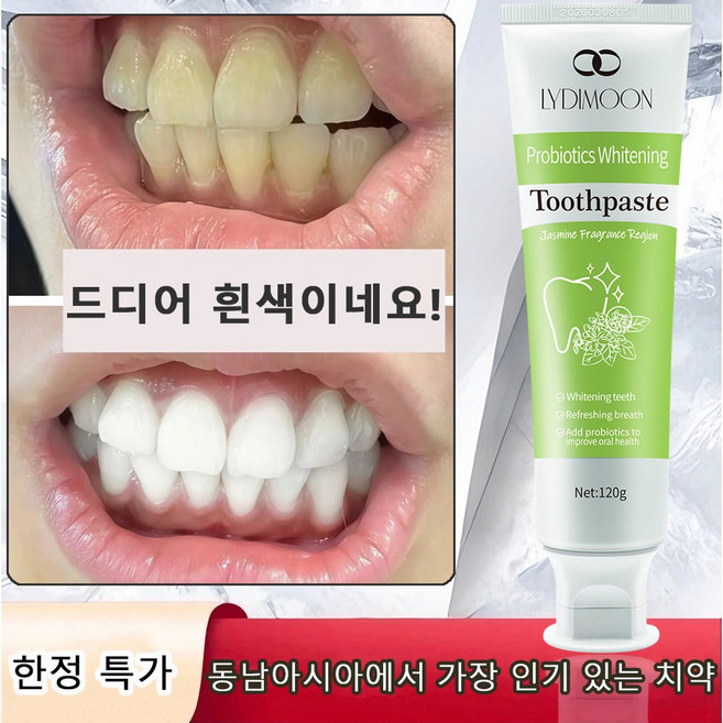 미백 치약은 입냄새를 제거하고 얼룩과 치석을 없애줍니다, 2개, 120ml
