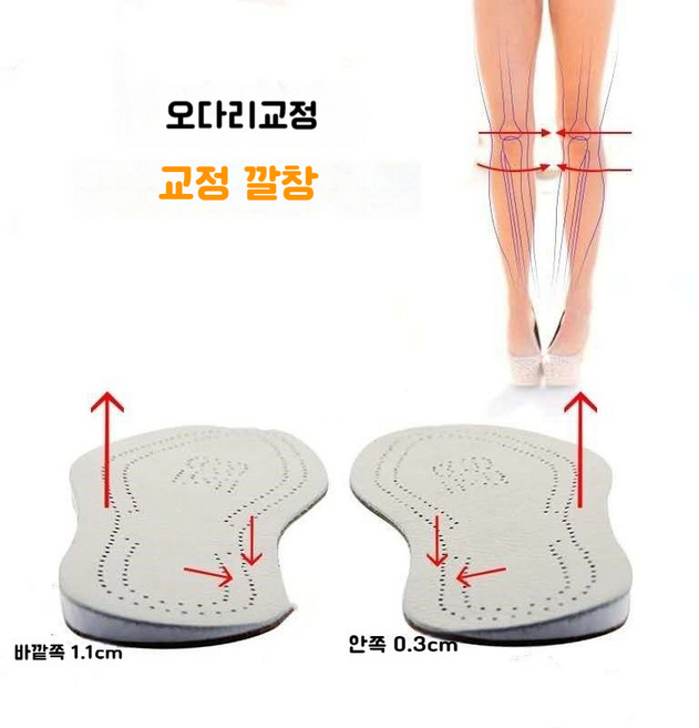 JINGHENG 오다리교정 O 다리 교정 깔창 교정 발 거꾸로 뻗은 발 교정 깔창 남녀 겸용 양면 가죽