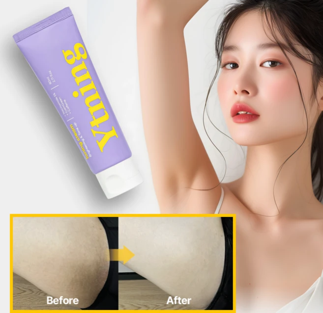 와이트닝 Y존 겨드랑이 착색전용 바디 미백 화이트닝 톤업 토닝 크림 팔꿈치 엉덩이 사타구니 색소침착 개선 기미잡티 멜라닌, 1개, 80ml - 쿠팡