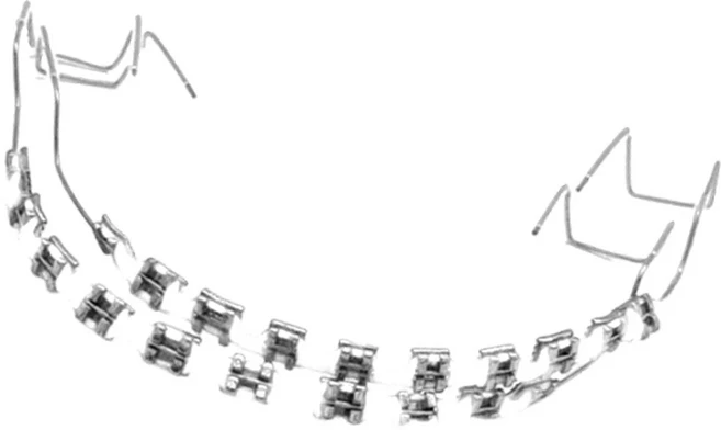 트렌디한 교정기 주얼리 세트 2개 | 화려한 치아 교정기 반짝이 체인 | 소녀 및 청소년을 위한 치아 교, 03 Transparent