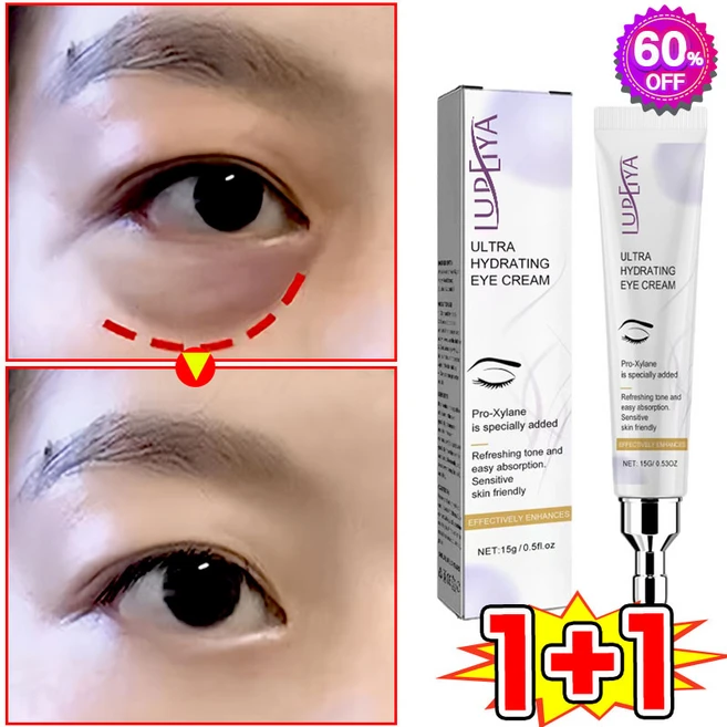 [피부과 추천] 1/1+1/2+2 눈밑지방 아이백 리프팅 아이크림 눈 밑 지방 제거 크림 아이백 크림 다크서클 눈밑꺼짐 제거 눈가 주름개선 LUPEIYA 포장증정, 2개, 15g - 쿠팡