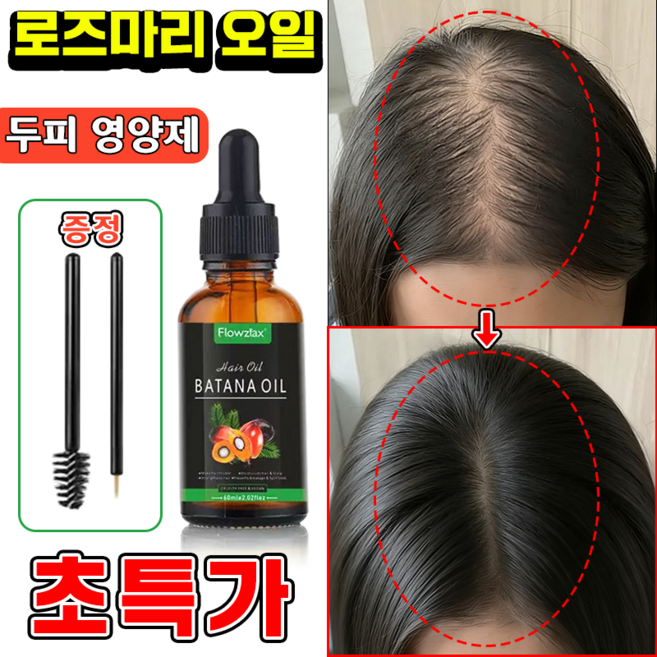 로즈마리 에센셜 오일 100% 탈모 두피용 로즈마리오일 바타나 헤어오일 헤어에센스 두피 영양제 모발 관리, 1개, 30ml