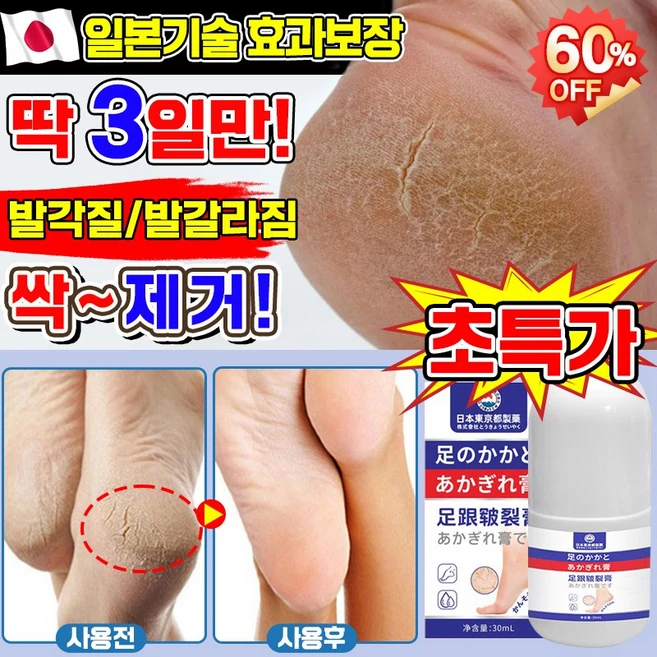 [고보습] 일본기술 1/1+1/2+2 풋크림 발각질제거 크림 풋케어 스틱 발크림 발뒤꿈치 굳은살 제거 발갈라짐 크림, 30ml, 1개, 1개입 - 쿠팡