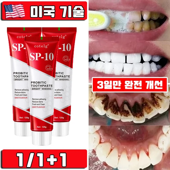 미국 1/1+1 SP10 미백 치약 누렁니 제거 입냄새 제거 프로바이오틱 화이트닝 미백 치약 치아미백 대용량 프리미엄 사은품 랜덤 증정, 1개, 120g - 쿠팡