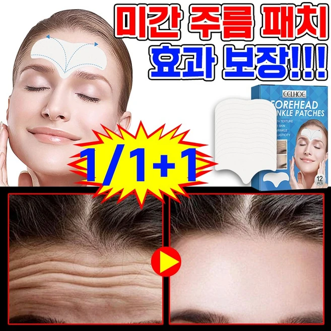 [국내 배송] 1/1+1 콜라겐 미간 주름 패치 스팟 패치 이마 팔자 눈가 주름 개선 패치 효과적인 패치, 1개, 12개입 - 쿠팡