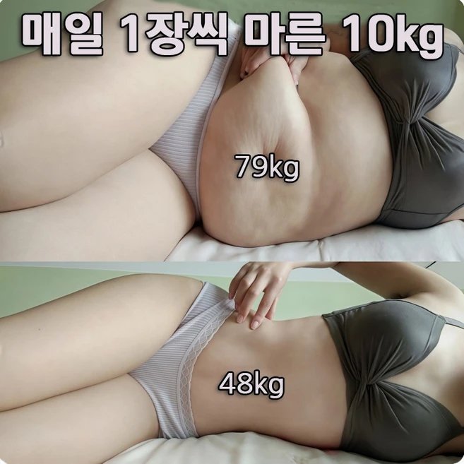 당일배송 12패치 다이어트 패치 지방부종제거 관리 지흡패치, 12매, 1개 - 쿠팡