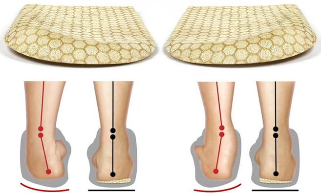 발기 및 과발현을 위한 BIGGCOOL 교정 깔창 발 정렬 활 다리 무릎 통증을 Orthotics 내측 외측 힐 웨지 삽입물(블랙-2 레이어 L: 여성 8-12/남성: 7.