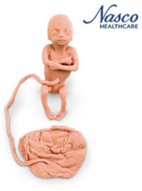 20주 태아모형(Female) [LF00829], 여자 태아, 단품