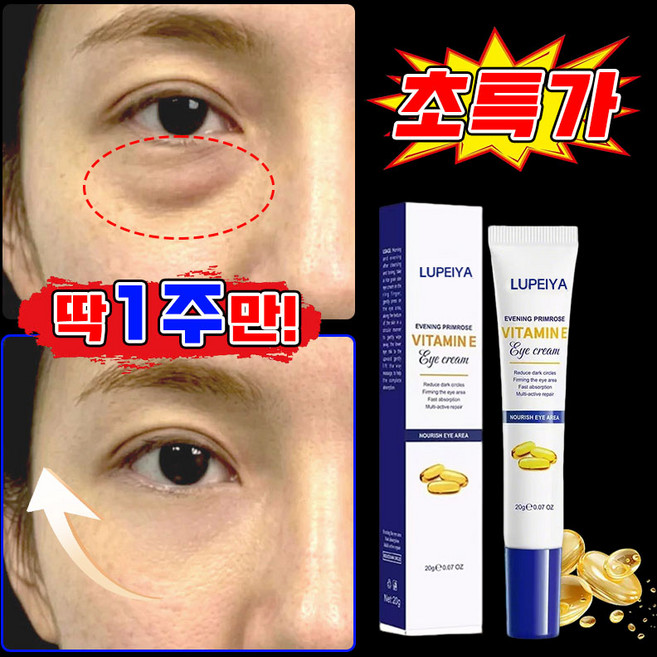 여성 아이크림1위 눈 밑 지방 제거 크림 주름개선 아이크림 눈가 리프팅 눈밑주름 제거 크림 영양크림 레티놀 아이크림 다크서클 눈밑 아이백 제거 콜라겐 아이크림 MOYALIE, 1개, 20g