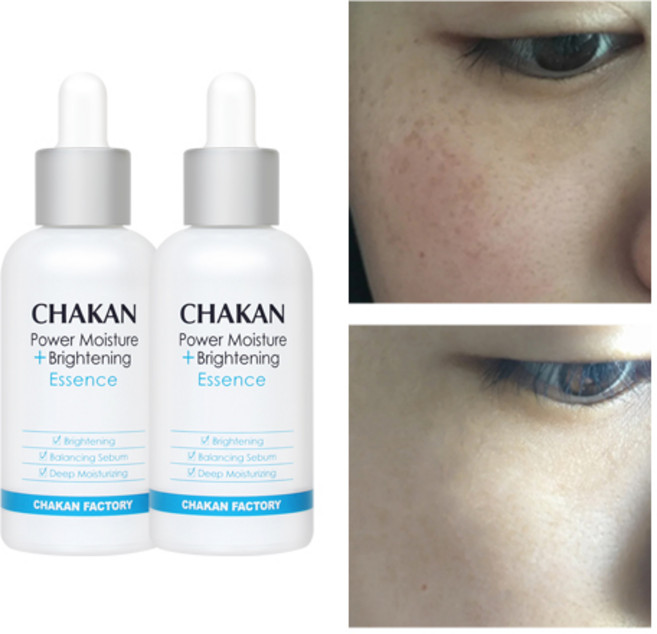 기미 잡티 주근깨 미백 색소침착 착색 검버섯 수분 보습 화이트닝 광채 기미잡티 에센스, 2개, 50ml