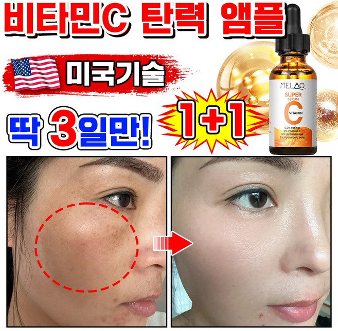 [100%제거] 1/1+1/2+2 비타민C 세럼 비타민 미백 앰플 기미 잡티 제거 에센스 비타씨플러스 잡티씨 탄력앰플 화이트닝 모공 수축, 2개, 30ml