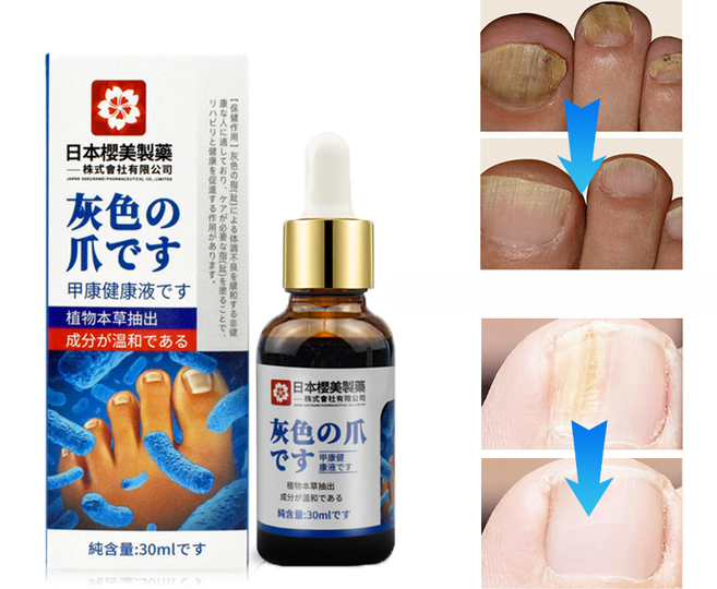 [국내당일출고] 발톱 앰플 발톱 곰팡이 문제성발톱 영양제, 1개, 29ml