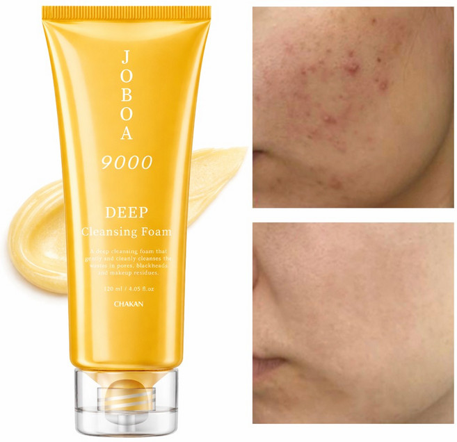 여드름 모공 각질 노폐물 제거 호호바 9000 딥 클렌징폼, 120ml, 1개