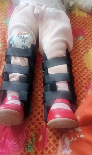 yulmubao 휜다리 오다리교정기 오자다리 틀어짐 자세, 어린이 20cm 69-78cm 적합