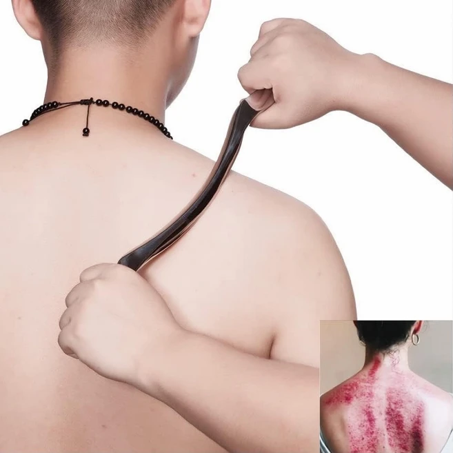 YUEMEIYD 마사지스틱 근막이완 롱 괄사도구 마사지스틸 전신용 스틱, 은색 스테인리스 스틸, 1개 - 쿠팡