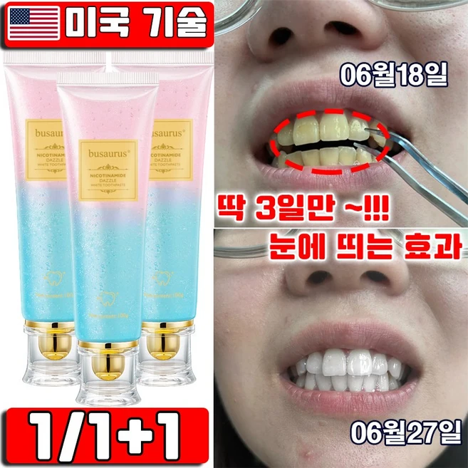[미국 기술] 1/1+1/2+2 나이아신아마이드 미백 치약 누렁니 제거 구취 제거 화이트닝 입냄새 얼룩제거 Busaurus 치솔 사은품 50개 증정, 100g, 1개 - 쿠팡