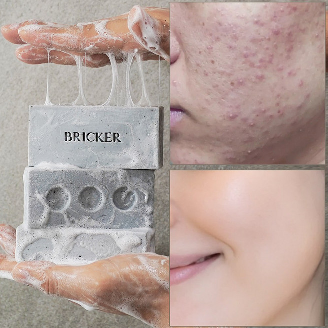 브릭커 머디 어성초 CP 천연비누 (머드팩 고체팩), 3개입, 140g