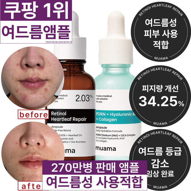 3일 여드름 순삭 진정 모공면적감소 피지감소 임상완료 [270만병 판매기념 할인] 고함량 레티놀 어성초 히알루론산 나이아신아마이드 뮤아마 앰플 세럼 2개 세트, 1개, 60ml