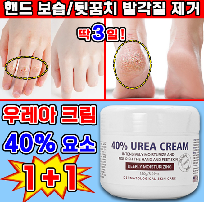 유리아 크림 우레아 풋크림 함익병 유레아 크림 뒷꿈치 피부연화제 유리아크림 발 각질제거 고보습 풋크림 사은품 증정, 149g, 2개, 1개입