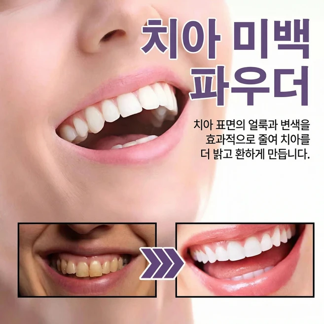 치아 관리 파우더 80g 흡연 얼룩 커피 착색 클리닝 구강 청결제 미백 치약 치아미백 치아미백제 1개 80ml, 80ml × 1개 - 쿠팡