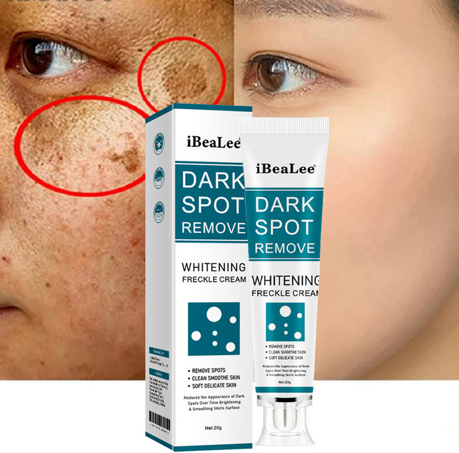 국내출하 (당일발송) 검버섯 황갈반 크림 미백크림, 20g, 1개