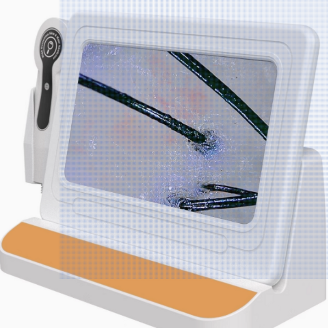 두피진단기 피부측정기 모낭충 피부 관찰 현미경 카메라 (22.3X12.3cm 11인치형), 골드(22.3X12.3cm 11인치형), 11인치 200배 + 백색광 50배