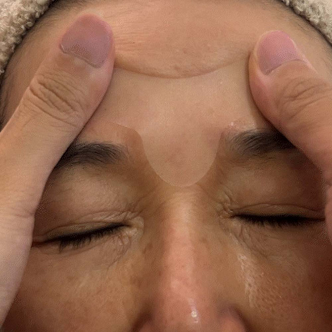 미간주름패치 리프팅 테이프 팔자 이마 눈가 콧등 입가 눈밑 얼굴 주름 제거, 1개