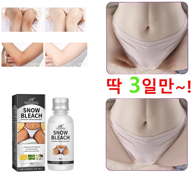 [랜덤 사은품 증정] 겨드랑이 착색 미백 크림 멜라논크림 멜라토닝크림 겨드랑이 색소침착 색소침착연고 멜라닌 억제, 4개, 30ml