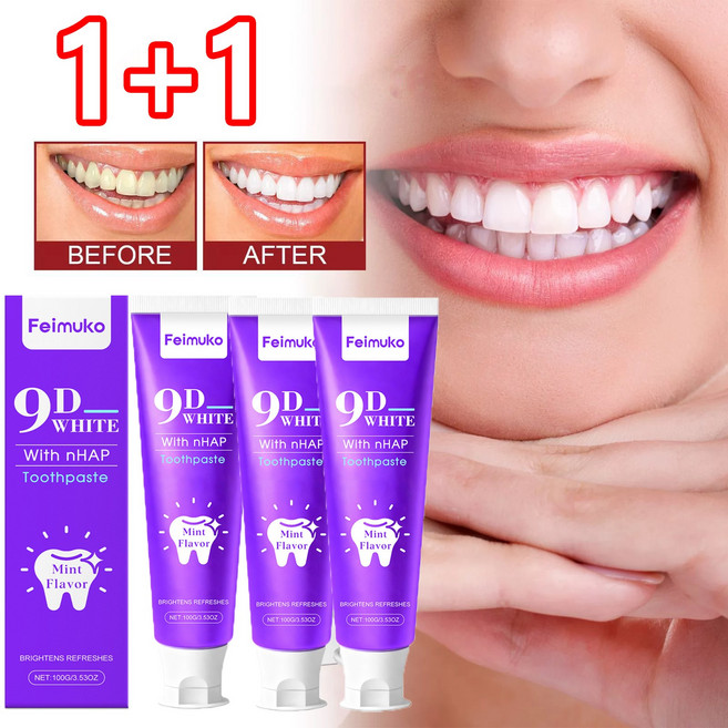 1+1 치약 추천 1위 교정 치아 케어 전용 치약, 2개, 100ml