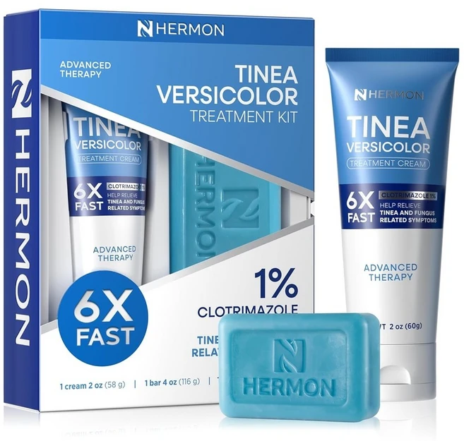 HERMON Tinea Versicolor 크림 비누 세트, 2 Fl Oz (1팩) - 쿠팡