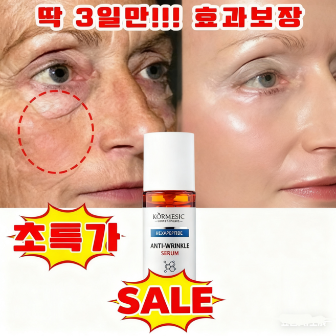 주름개선 크림 팔자주름 제거 크림1위 팔자필러크림 여성 수분크림1위 얼굴 주름 없애는 크림 주름 미백 탄력크림 90초회춘팔자주름크림 여성 영양크림 추천 60대, 30g, 1개