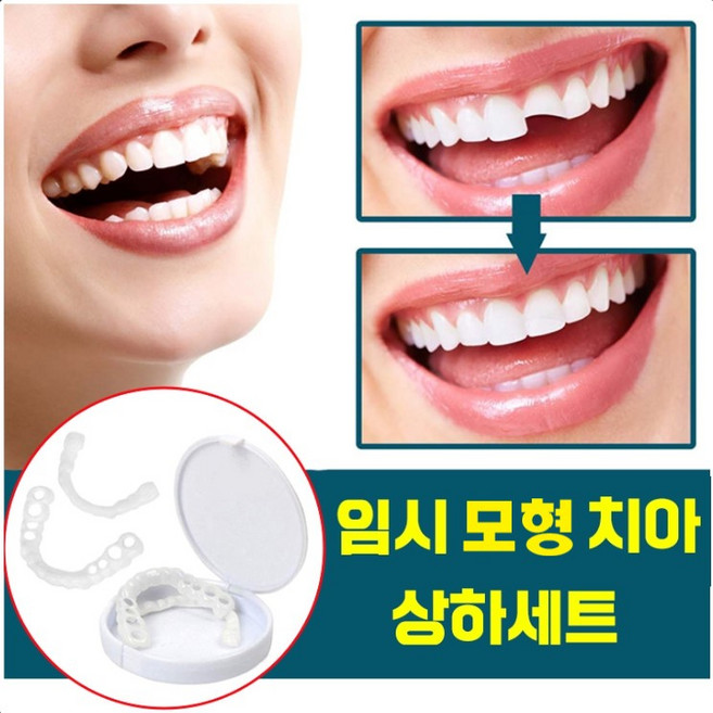 [국내배송] 실리콘 틀니 미아 가짜 치아 장식 세트 임시치아 교정기 상하 이빨 셀프 만들기 보관함증정, 1개