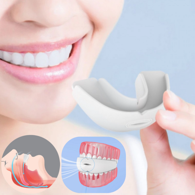 유디드 성형없는 코골이 이갈이방지 마우스피스, 1개