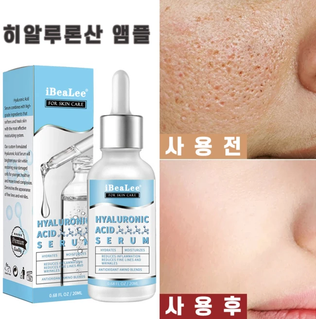 저분자 히알루론산 원액 앰플 모공축소 주름개선 세럼 비타민C 비타민E 앰플, 3개, 20ml - 쿠팡