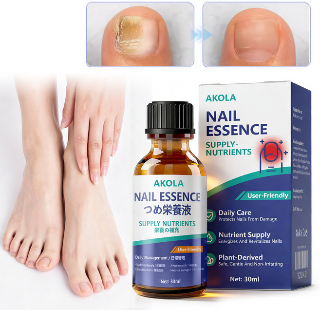 [휴일에도 정상 발송합니다] 문제성 손발톱 전용 앰플 영양액 발톱 강화 및 종합적인 손발톱 케어, 1개, 30ml