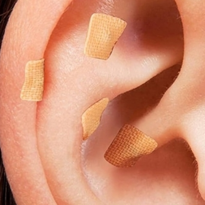 침밴드 셀프침 압봉침 침압봉 귀혈점 귀혈자리 귀침붓기 귀혈자리붓기, 스킨, 600개