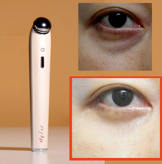 [펄화이트]눈밑 마사지기 마일레스 눈밑지방 다크서클 전용 뷰티디바이스 눈가 주름 마사지, 펄화이트