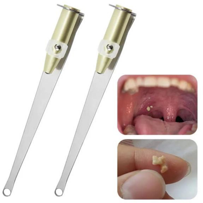 편도결석흡입기 편도결석치약 셀프치석제거기 LED 라이트 스테인레스 스틸 리무버 입 청소 관리 도구 편도선 스톤 1Pcs 귀 왁스, [01] 옵션1, 1개