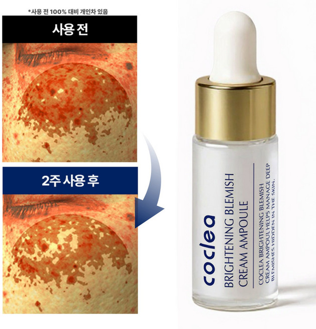 코클레아 브라이트닝 레티놀 콜라겐 기미 잡티 앰플, 1개, 10ml