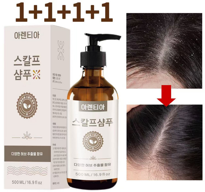 지루성 두피염 샴푸 여성 샴푸 1 위 향기좋은샴푸 비듬 샴푸 비듬균 제거 두피 가려움 개선 약산성 샴푸 손상모 샴푸 여자 남자 비듬샴푸 1위 남자 비듬샴푸 1위 두피 스케일링 샴푸, 4개, 500ml