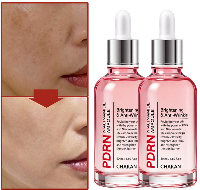 기미 잡티 주근깨 보습 모공 피디알엔 PDRN 나이아신아마이드 앰플, 2개, 50ml