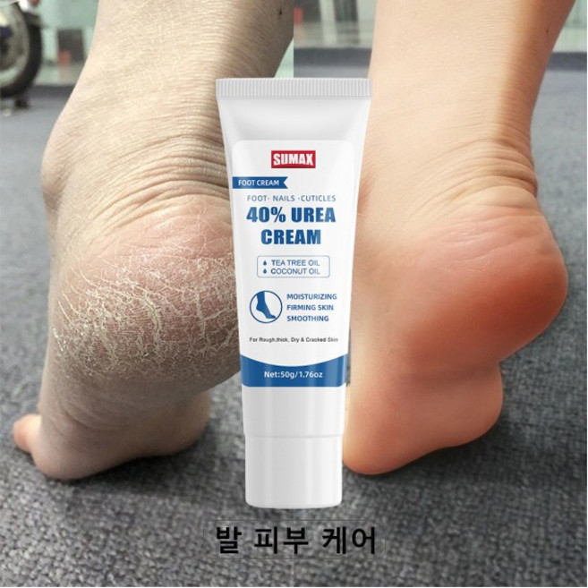 크림 풋크림 우레아 풋크림 발 관리 거칠고 벗겨지는 발 문제 해결, 1개