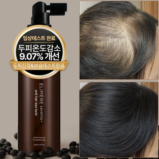세이브모 탈모증상완화 헤어토닉 임상완료(두피온도감소) 식약처인증 탈모완화 기능성 헤어토닉, 150ml, 1개 - 쿠팡